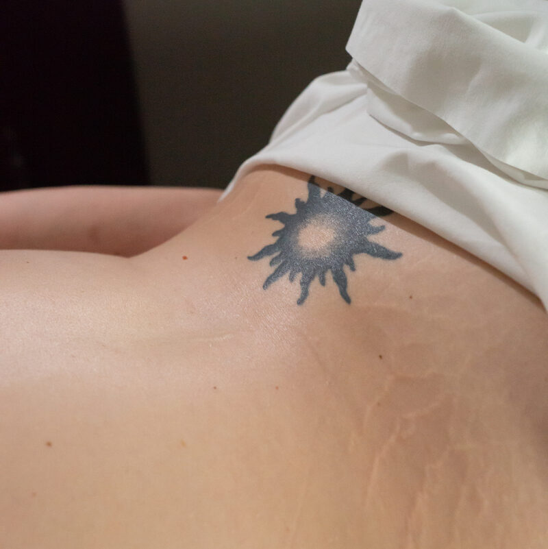 A massage therapist massages her patient on a massage table in a small room with white walls. There's a white sheet and gray blanket on the table. Patient has a tattoo and stretch marks.